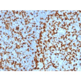 ZAP70 (Chronic Lymphocytic Leukemia Marker)(ZAP70/2047), CF647 conjugate, 0.1mg/mL