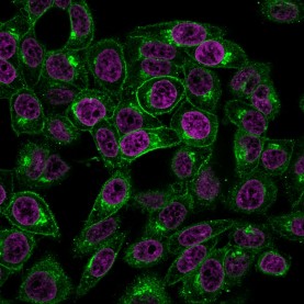 Beta-2 Microglobulin (B2M)(BBM.1), CF568 conjugate, 0.1mg/mL