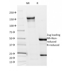 Biotium BNC680144-100, Borrelia burgdorferi (p41 Flagellin)(6802),  CF568 conjugate, 0.1mg/mL