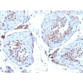 SHBG (Sex Hormone Binding Globulin)(SHBG/245), CF568 conjugate, 0.1mg/mL