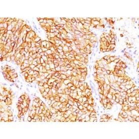 Renal Cell Carcinoma (Carbonic Anhydrase IX)(66.4.C2), CF568 conjugate, 0.1mg/mL