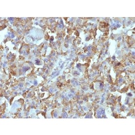 Small Cell Lung Cancer (SCLC)(MOC-52), CF568 conjugate, 0.1mg/mL