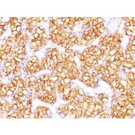 Renal Cell Carcinoma (Carbonic Anhydrase IX)(PN-15), CF568 conjugate, 0.1mg/mL