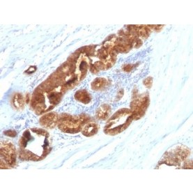 TAG-72 / CA72.4(CC49), CF568 conjugate, 0.1mg/mL