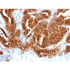 TAG-72 / CA72.4(CA72/733), CF568 conjugate, 0.1mg/mL