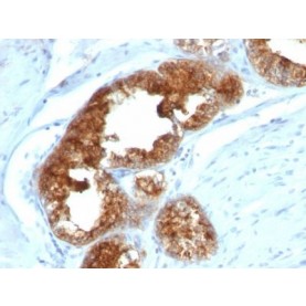TAG-72 / CA72.4(B72.3 + CA72/733), CF568 conjugate, 0.1mg/mL