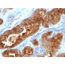 TAG-72 / CA72.4(B72.3 + CC49), CF568 conjugate, 0.1mg/mL