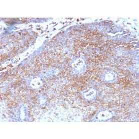 Beta-2-Microglobulin (B2M)(B2M/1118), CF568 conjugate, 0.1mg/mL