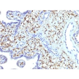 S100A4 (Marker of Tumor Metastasis) (S100A4/1481), CF568 conjugate, 0.1mg/mL
