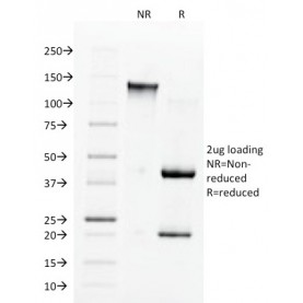 Biotium BNC681560-100, Angiotensin I Converting Enzyme (ACE) / CD143(9B9), CF568 conjugate, 0.1mg/mL