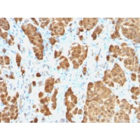 S100B (Astrocyte and Melanoma Marker) (S100B/1706R), CF568 conjugate, 0.1mg/mL