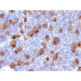 CD30 / TNFRSF8 (Hodgkin & Reed-Sternberg Cell Marker) (Ki-1/1747R), CF568 conjugate, 0.1mg/mL