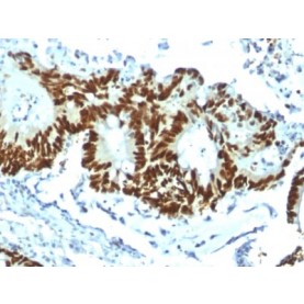 p53 Tumor Suppressor Protein (TP53/1799R), CF568 conjugate, 0.1mg/mL