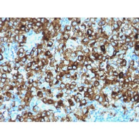 gp100 / Melanosome / PMEL17 / SILV (Melanoma Marker)(N/A), CF568 conjugate, 0.1mg/mL