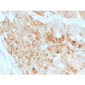 ROR2(ROR2/1911), CF568 conjugate, 0.1mg/mL
