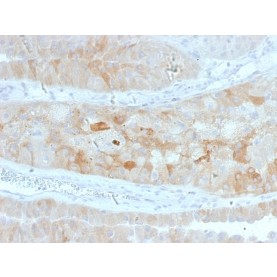 ROR2(ROR2/1912), CF568 conjugate, 0.1mg/mL