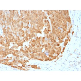 S100A1 (Melanoma Marker)(S100A1/1942), CF568 conjugate, 0.1mg/mL