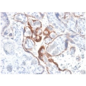 HCG-beta (Pregnancy & Choriocarcinoma Marker)(HCGb/1985R), CF568 conjugate, 0.1mg/mL