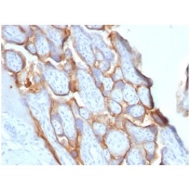 HCG-beta (Pregnancy & Choriocarcinoma Marker)(HCGb/1996R), CF568 conjugate, 0.1mg/mL