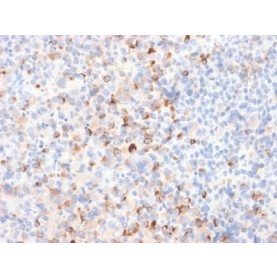 Tyrosinase (Melanoma Marker) (TYR/2024R), CF568 conjugate, 0.1mg/mL