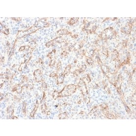 TNFS15 / VEGI (Vascular Endothelial Growth Inhibitor) (rVEGI/1283), CF568 conjugate, 0.1mg/mL