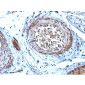 StAR (Steroidogenic Acute Regulator) (Leydig Cell Marker)(STAR/2077), CF568 conjugate, 0.1mg/mL