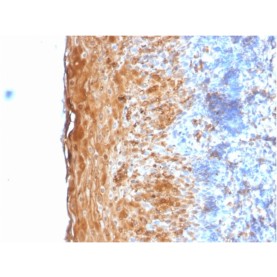 Involucrin (Squamous Cell Terminal Differentiation Marker)(IVRN/2113R), CF568 conjugate, 0.1mg/mL
