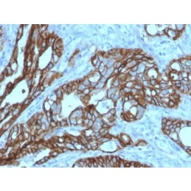 TACSTD2 / TROP2 (Epithelial Marker) (TACSTD2/2152), CF568 conjugate, 0.1mg/mL