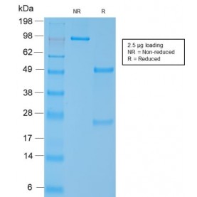 Smooth Muscle Myosin Heavy Chain (SM-MHC) (MYH11/2303R), CF568 conjugate, 0.1mg/mL
