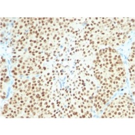 SOX10 (Melanoma Marker) (SOX10/2311R), CF568 conjugate, 0.1mg/mL