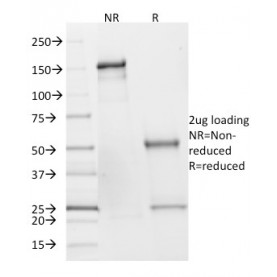 SDHB (Succinate Dehydrogenase B) (Pheochromocytoma Marker)(SDHB/2382), CF568 conjugate, 0.1mg/mL