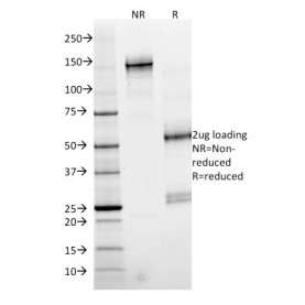 SMAD4 (Pancreatic Adenocarcinoma Marker)(SMAD4/2524), CF568 conjugate, 0.1mg/mL