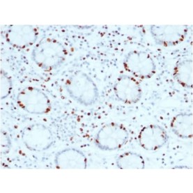 SOX4 (Master Regulator of Epithelial-Mesenchymal Transition) (SOX4/2540), CF568 conjugate, 0.1mg/mL