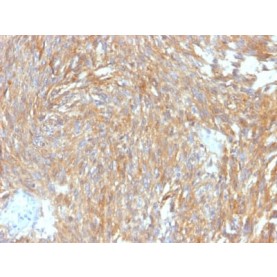 DOG-1 / TMEM16A (Gastrointestinal Stromal Tumor Marker) (DG1/2564R), CF568 conjugate, 0.1mg/mL