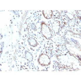 RAD51 (Prognostic and Response to Chemotherapy Marker)(RAD51/2702), CF568 conjugate, 0.1mg/mL