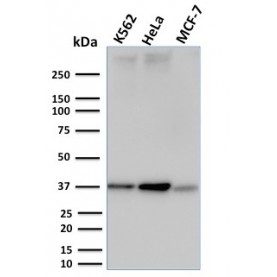 RAD51 (Prognostic and Response to Chemotherapy Marker)(RAD51/2753), CF568 conjugate, 0.1mg/mL