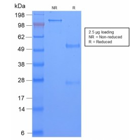 TAG-72 / CA72.4 (Tumor-Associated Glycoprotein)(CA72/2869R), CF568 conjugate, 0.1mg/mL