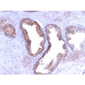 Prostate Specific Antigen (PSA) (KLK3/2871R), CF568 conjugate, 0.1mg/mL