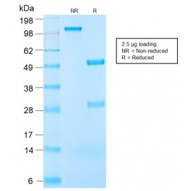 Insulin-like Growth Factor-1 (IGF-1) (IGF1/2872R), CF568 conjugate, 0.1mg/mL