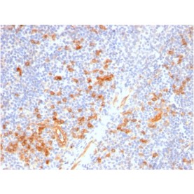 IL3RA / CD123 (Acute Myeloid Leukemia Marker)(IL3RA/2947R), CF568 conjugate, 0.1mg/mL