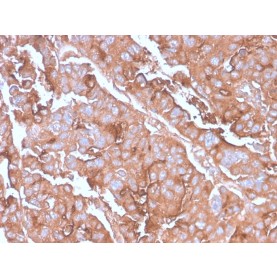 MUC1 / CA15-3 / EMA / CD227 (Epithelial Marker)(MUC1/2980R), CF568 conjugate, 0.1mg/mL