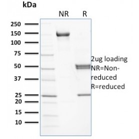 Spectrin beta I (SPTB)(RG/26), CF568 conjugate, 0.1mg/mL
