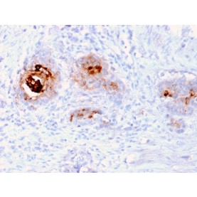 TAG-72 / CA72.4 (Tumor-Associated Glycoprotein)(rB72.3), CF568 conjugate, 0.1mg/mL