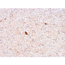 Serum Amyloid P / APCS(APCS/3240), CF568 conjugate, 0.1mg/mL