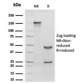 Retinol Binding Protein-1 (RBP1)(rRBP1/872), CF568 conjugate, 0.1mg/mL