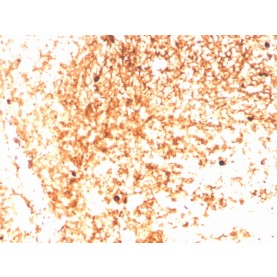 Human IgM (Immunoglobulin Mu Heavy Chain) (B-Cell Marker)(IGHM/3803R), CF568 conjugate, 0.1mg/mL