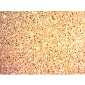 Arginase 1 (Hepatocellular Carcinoma Marker) (ARG1/1125) , CF740 conjugate, 0.1mg/mL