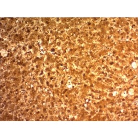 Arginase 1 (Hepatocellular Carcinoma Marker) (ARG1/1126) , CF740 conjugate, 0.1mg/mL