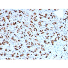 BARX1 (Prognostic Biomarker in Hepatocellular Carcinoma)(BARX1/2760), CF740 conjugate, 0.1mg/mL