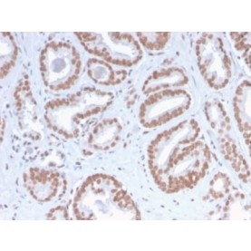 ATRX / RAD54 (Alpha Thalassemia Mental Retardation) (ATRX/2900R), CF740 conjugate, 0.1mg/mL